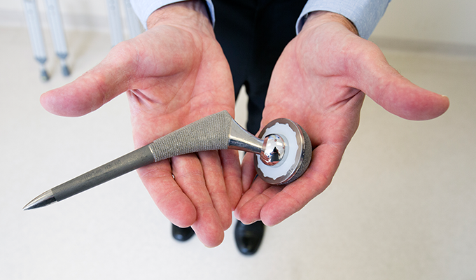 Photo of a hip joint and socket